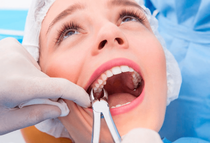 Когда следует удалять зубы?