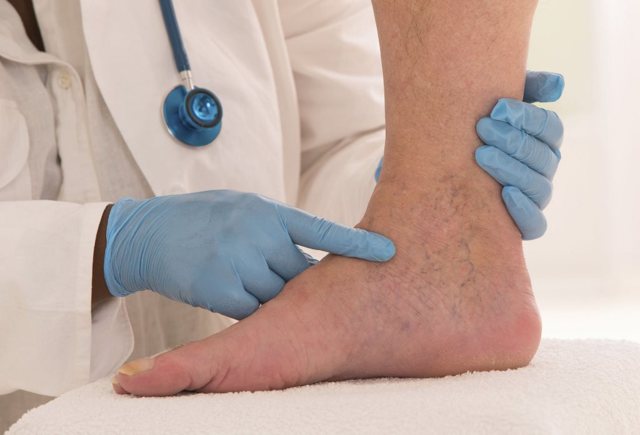 Начальная стадия варикоза на ногах: способы лечения и как распознать (симптомы, диагностика)