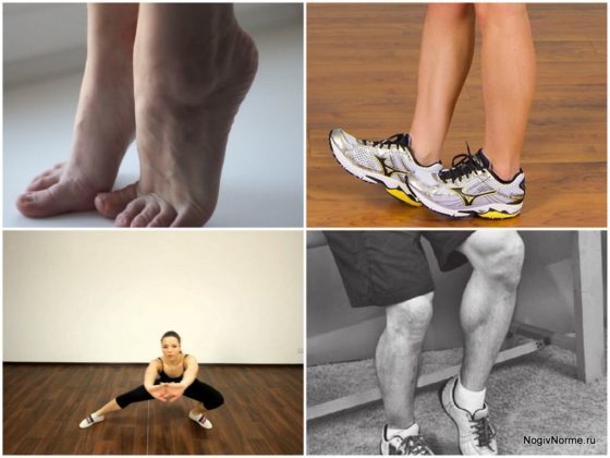 Упражнения при варикозе нижних конечностей: гимнастика, зарядка на работе, лечебная физкультура (лфк)
